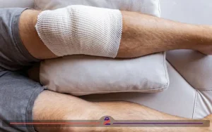 دوران نقاهت بعد از آرتروسکوپی زانو