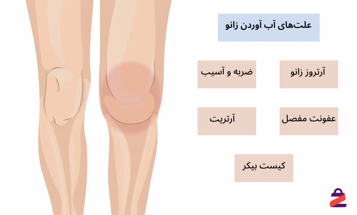 آب آوردن زانو