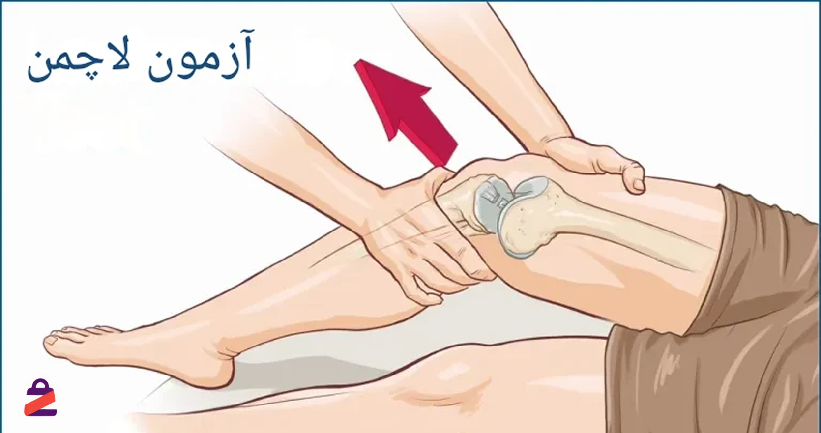 عکس تست لاکمن