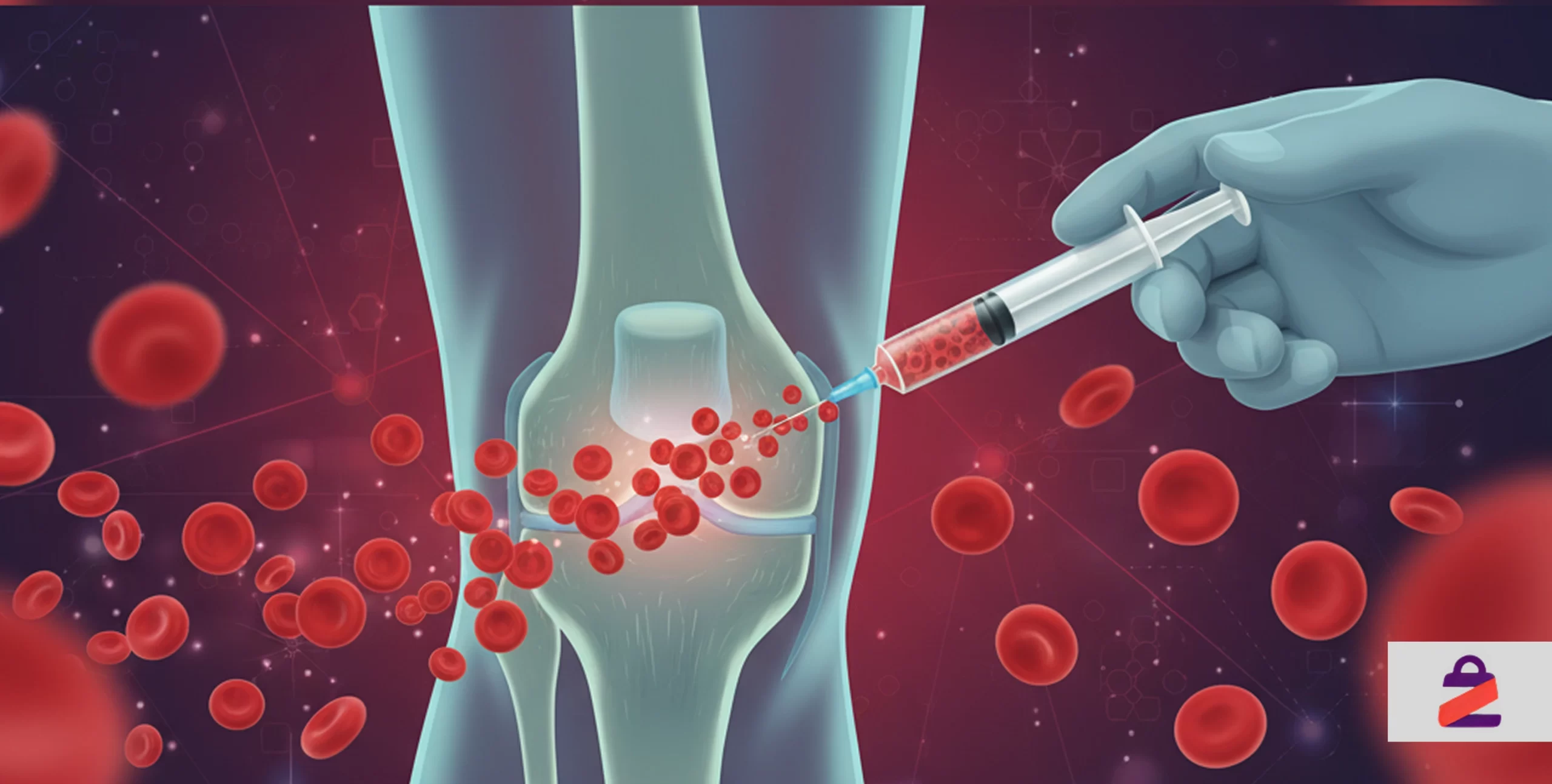 پی آر پی زانو