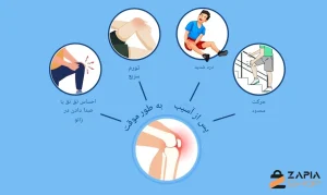 علائم پارگی رباط زانو
