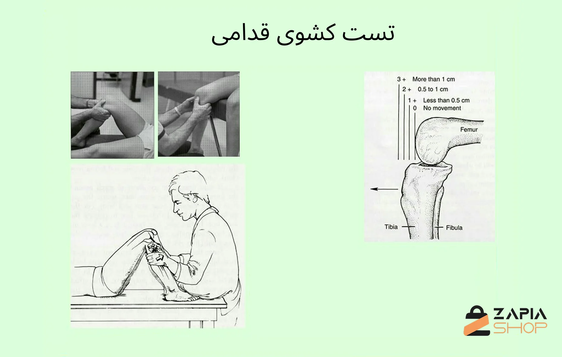تست پارگی رباط صلیبی