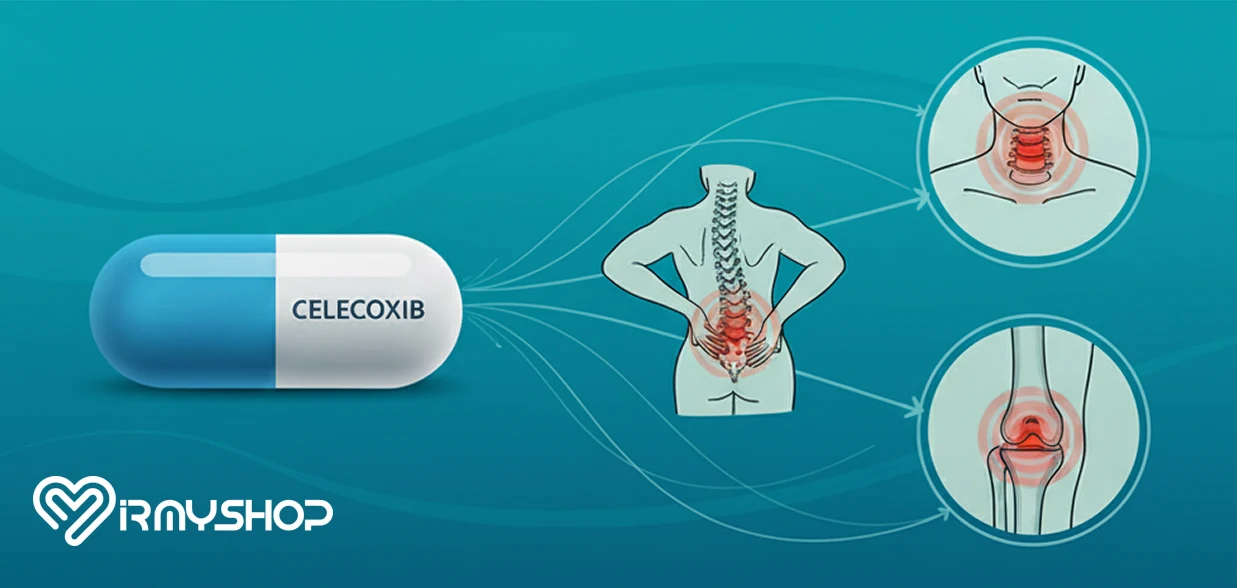 موارد مصرف قرص سلکوکسیب